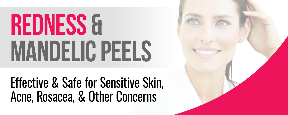 1200×630-Peel-RosaLieve-Special-BLOG-HEADER-1200×480