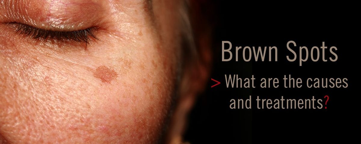 1200×633-Lytera-BLOG-1200×480