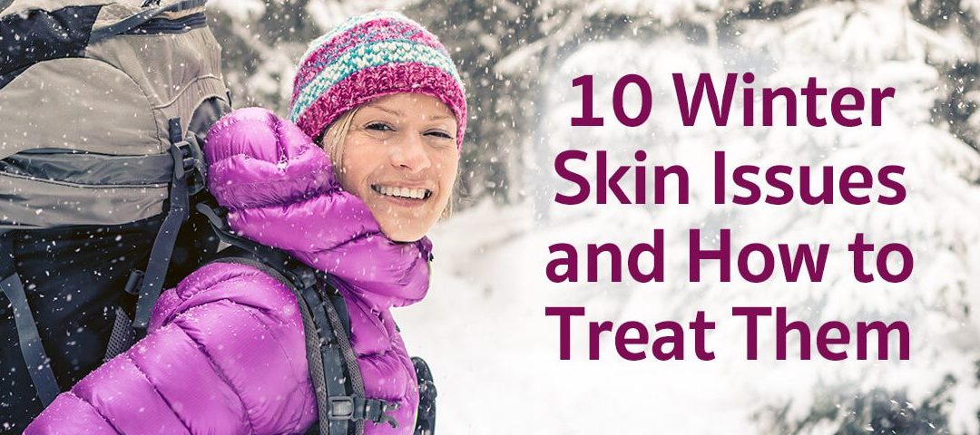 10 Winter Skin Issues and How to Treat Them