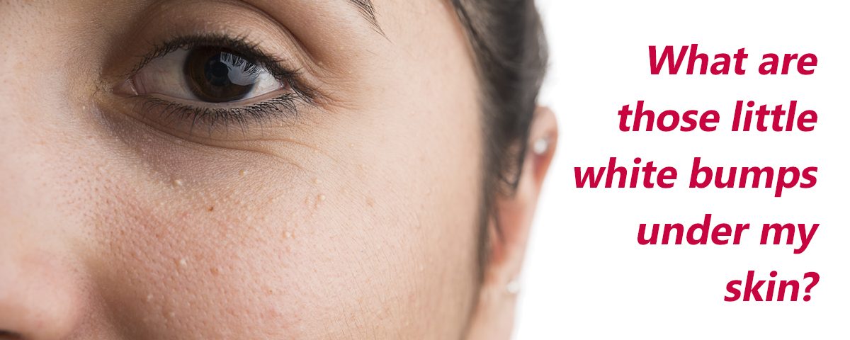 Little-White-Bumps__Blog-1200×480